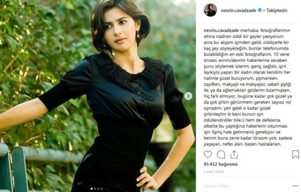 Nesrin Cavadzade 'estetik güzeli' iddialarına 10 yıllık fotoğrafla yanıt verdi! - Resim : 2