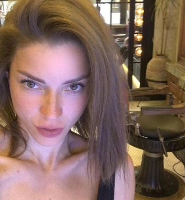 Ayrılık yaramadı! Üzüntüden saçkıran oldu - Resim : 1